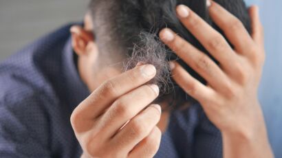 "rambut rontok usia muda penyebab", "kerontokan rambut remaja solusi",